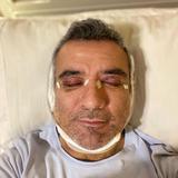 Héctor Sandarti se somete a cirugía en la cara y papada y muestra cómo quedó