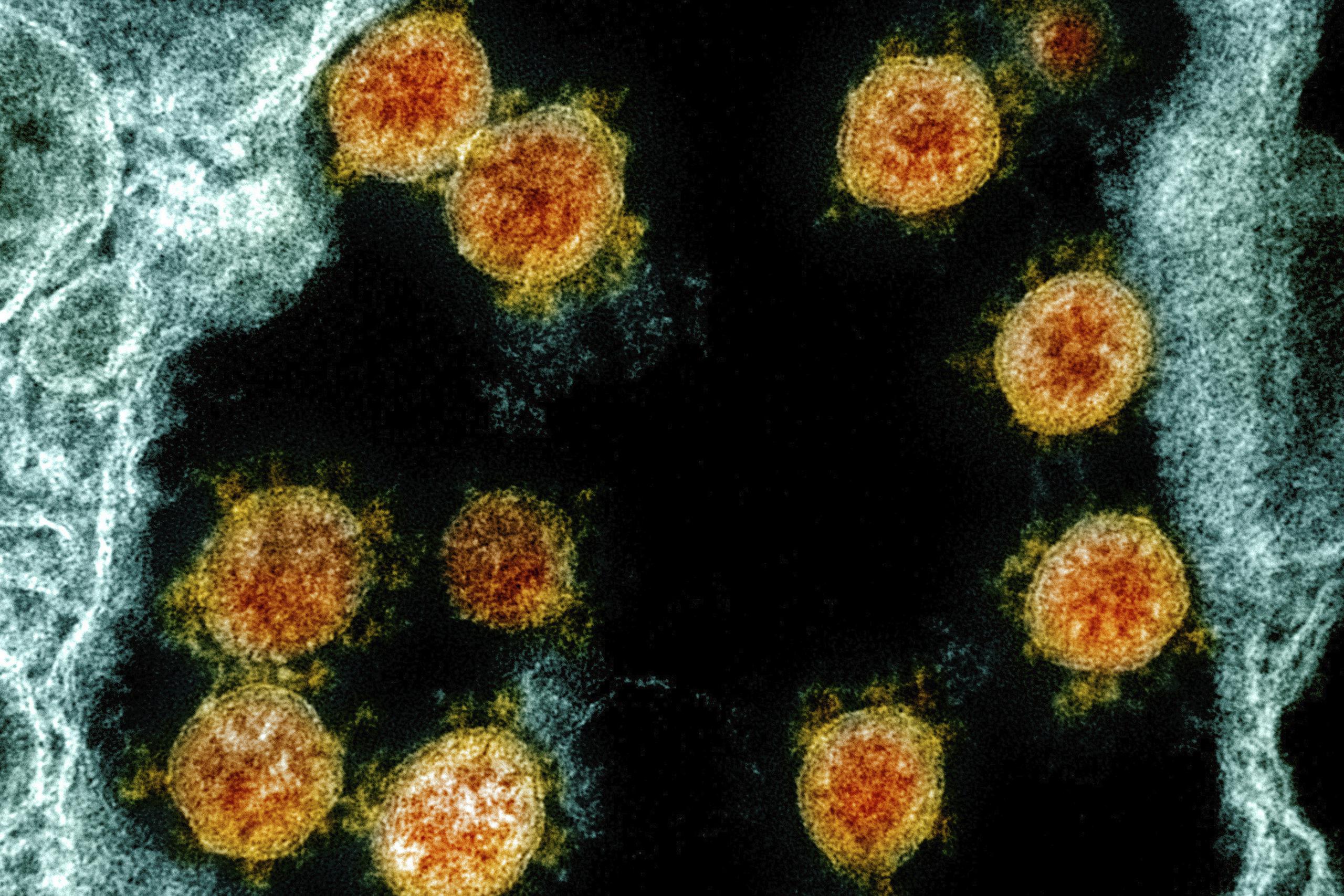Imagen tomada con un microscopio electrónico que muestra partículas del coronavirus SARS-CoV-2 aisladas de un paciente.