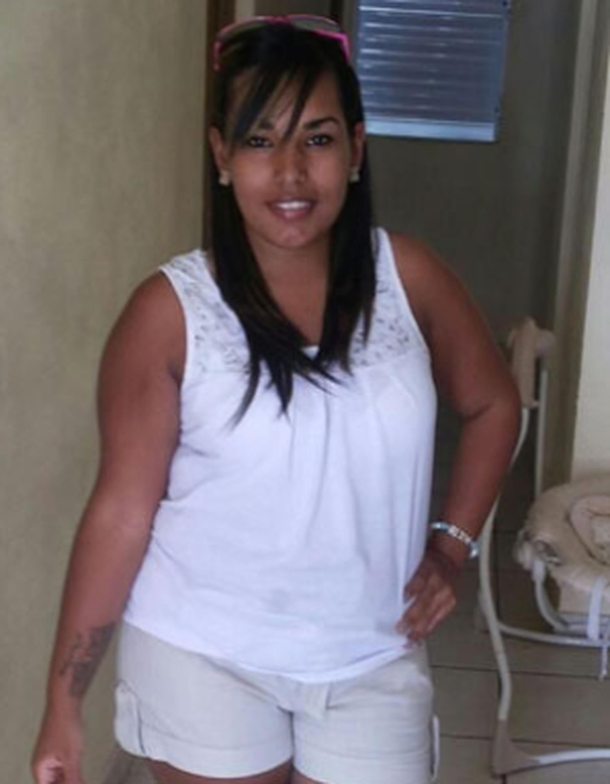 Marangelly Renta Pérez, de 22 años de edad, fue golpeada brutalmente en el rostro con un objeto punzante. (Facebook)