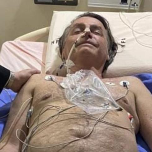 Evalúan a Bolsonaro para posible cirugía de emergencia por ataque de hipo
