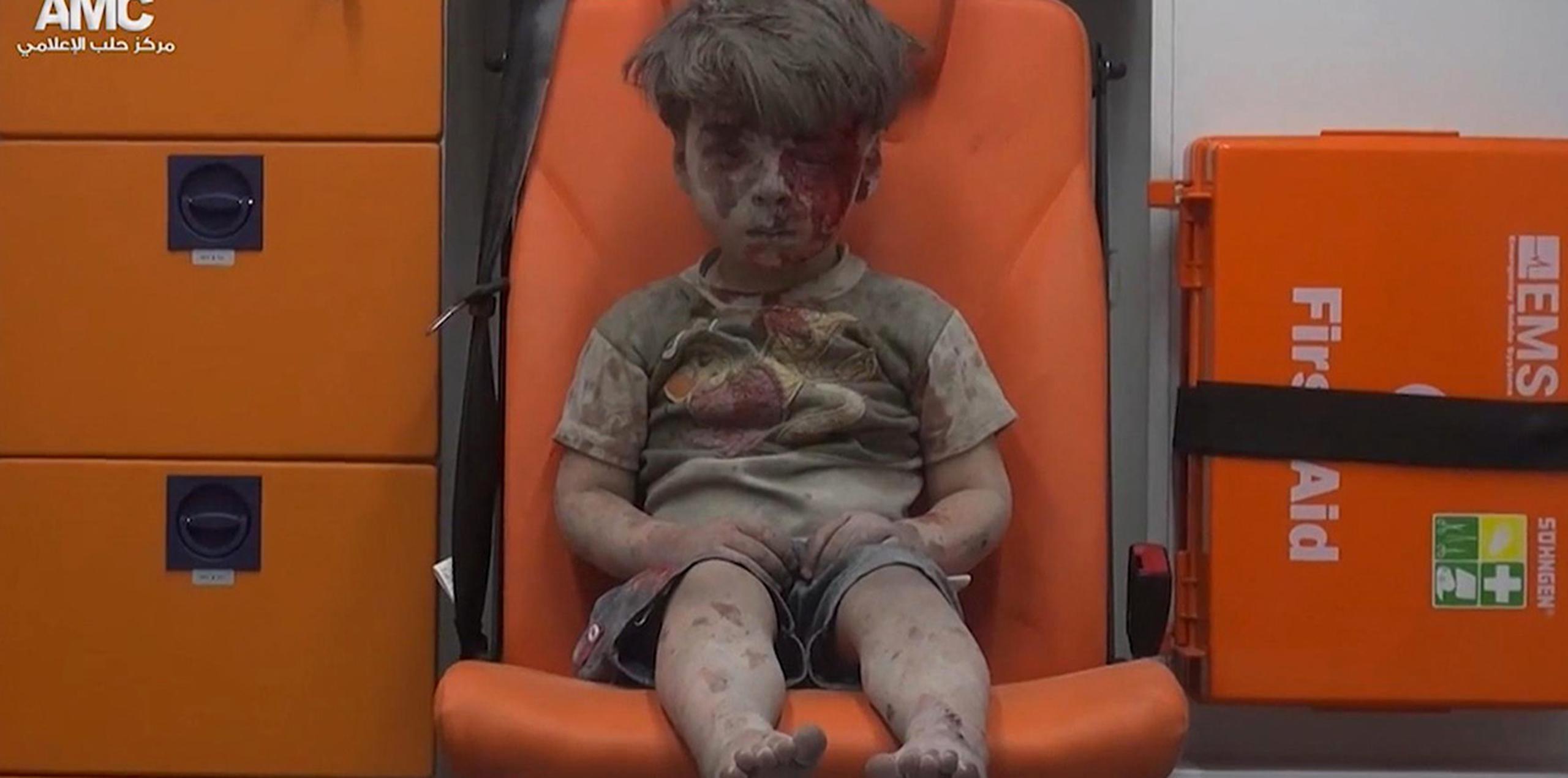 La imagen del pequeño, aturdido y cansado, sentado en la silla naranja de una ambulancia, cubierto de polvo y con sangre en la cara, pone cara al horror de la guerra en la ciudad del norte del país y se ha compartido ya miles de veces en medios sociales. (AP)