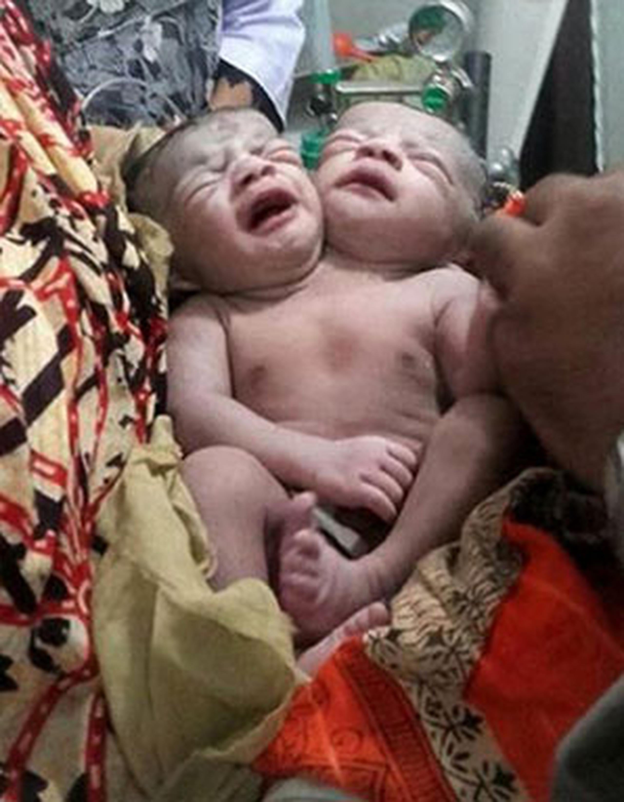 Han fallecido en el hospital público de Dacca, Bangladesh, en el que se encontraban. (AFP)