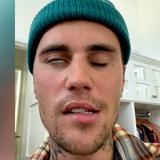 Justin Bieber publica video de su parálisis facial