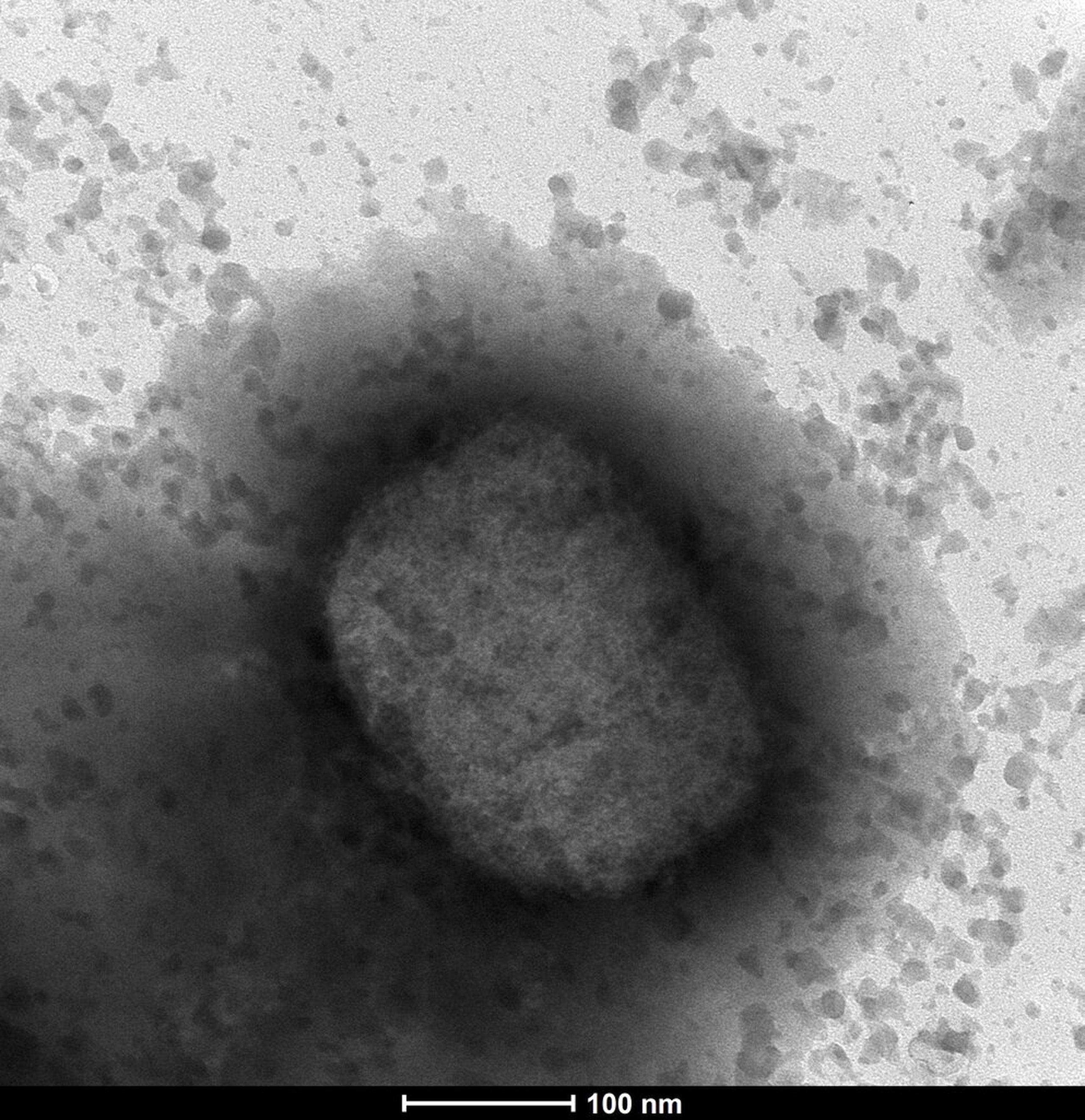 Esta foto suministrada por la Unidad de Microscopía Electrónica del ISCIII en Madrid, muestra el virus de la viruela del mono visto desde un microscopio electrónico.