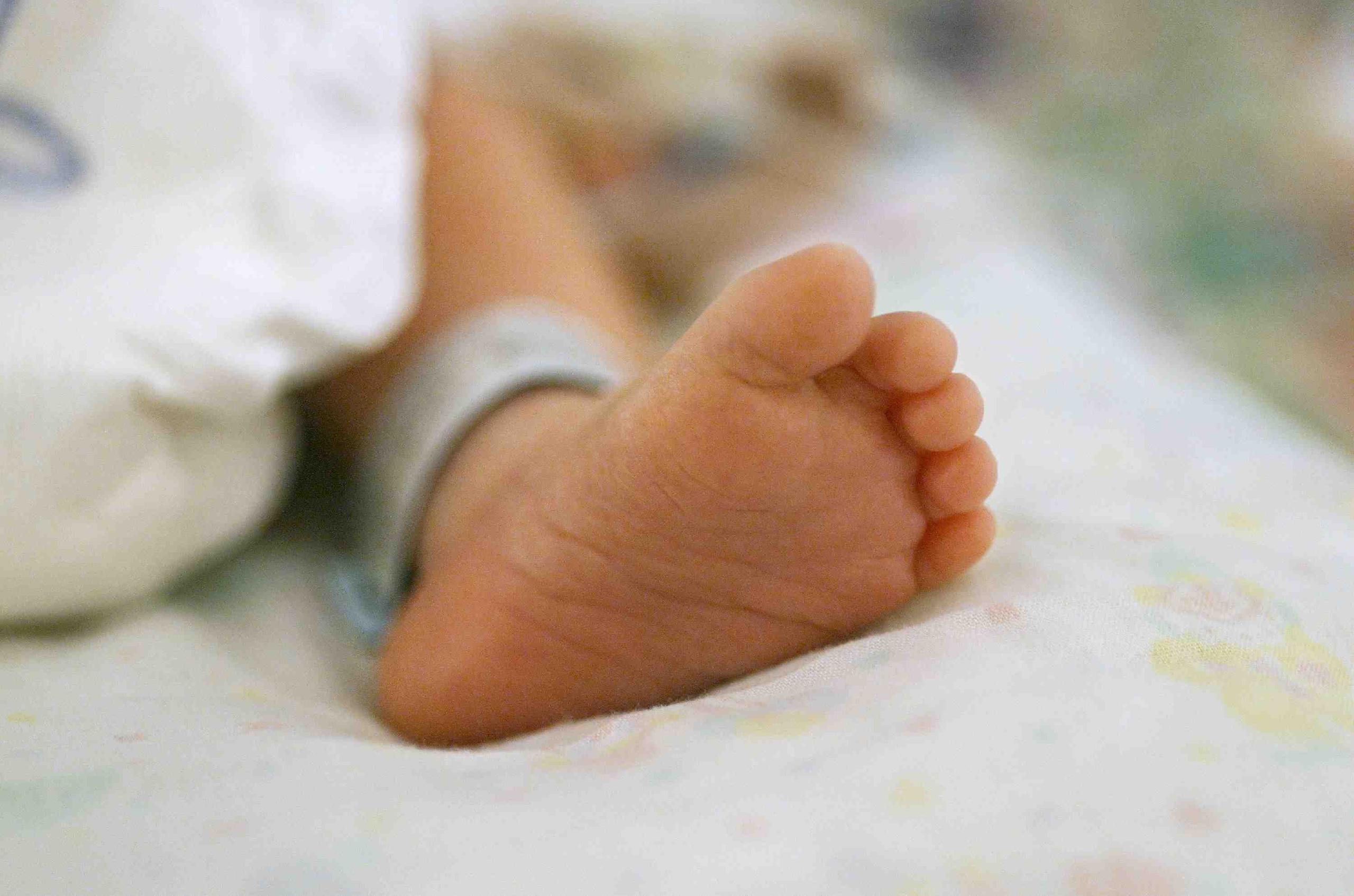 Estudios realizados a la bebé encontraron edema cerebral, así como fracturas en la pierna izquierda, específicamente en la tibia y el fémur. (GFR Media)