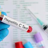 Beneficiarios de la Reforma de Salud tendrán acceso a medicamento para tratar la hepatitis