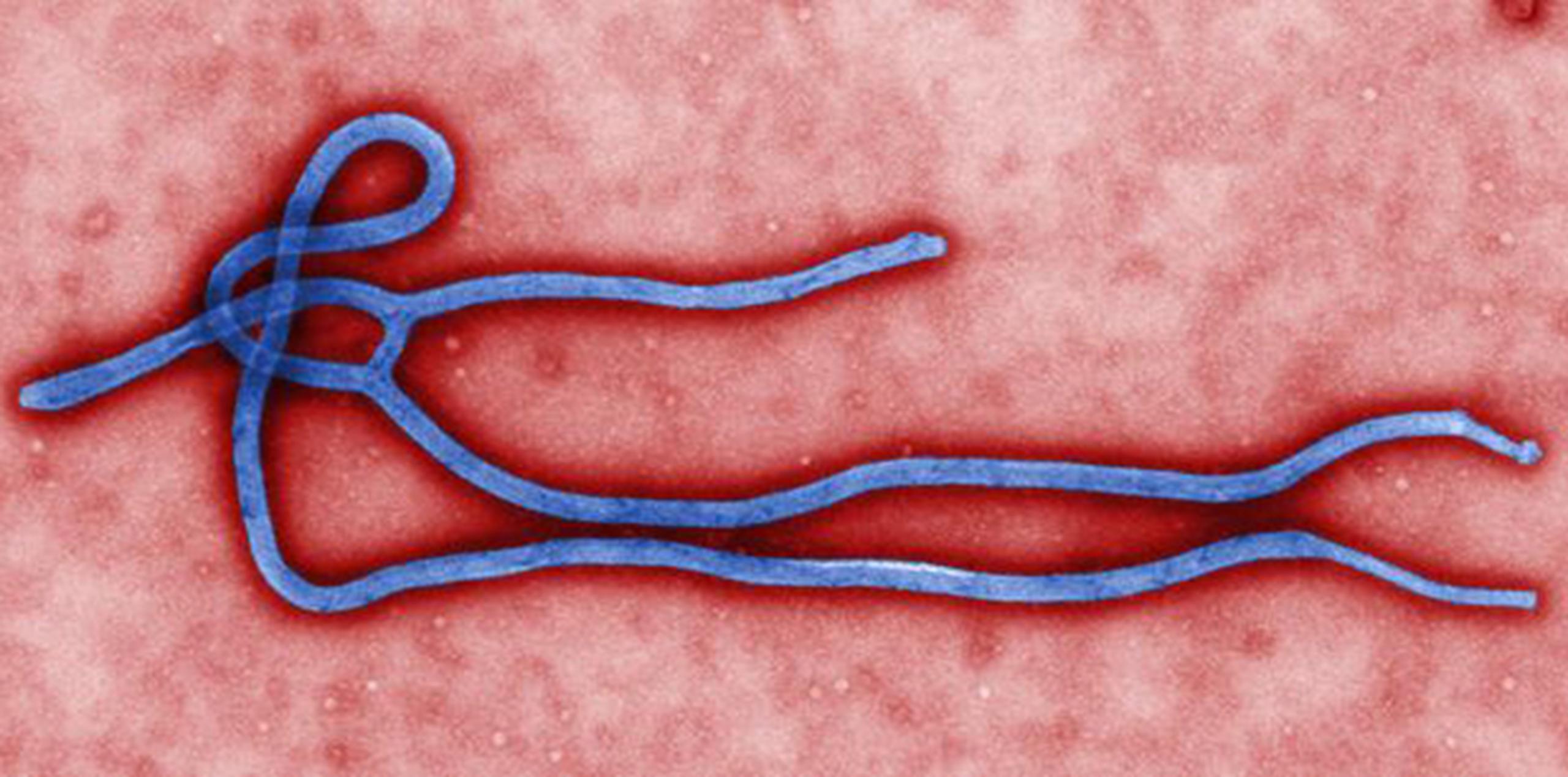 Virus del ébola (Archivo)