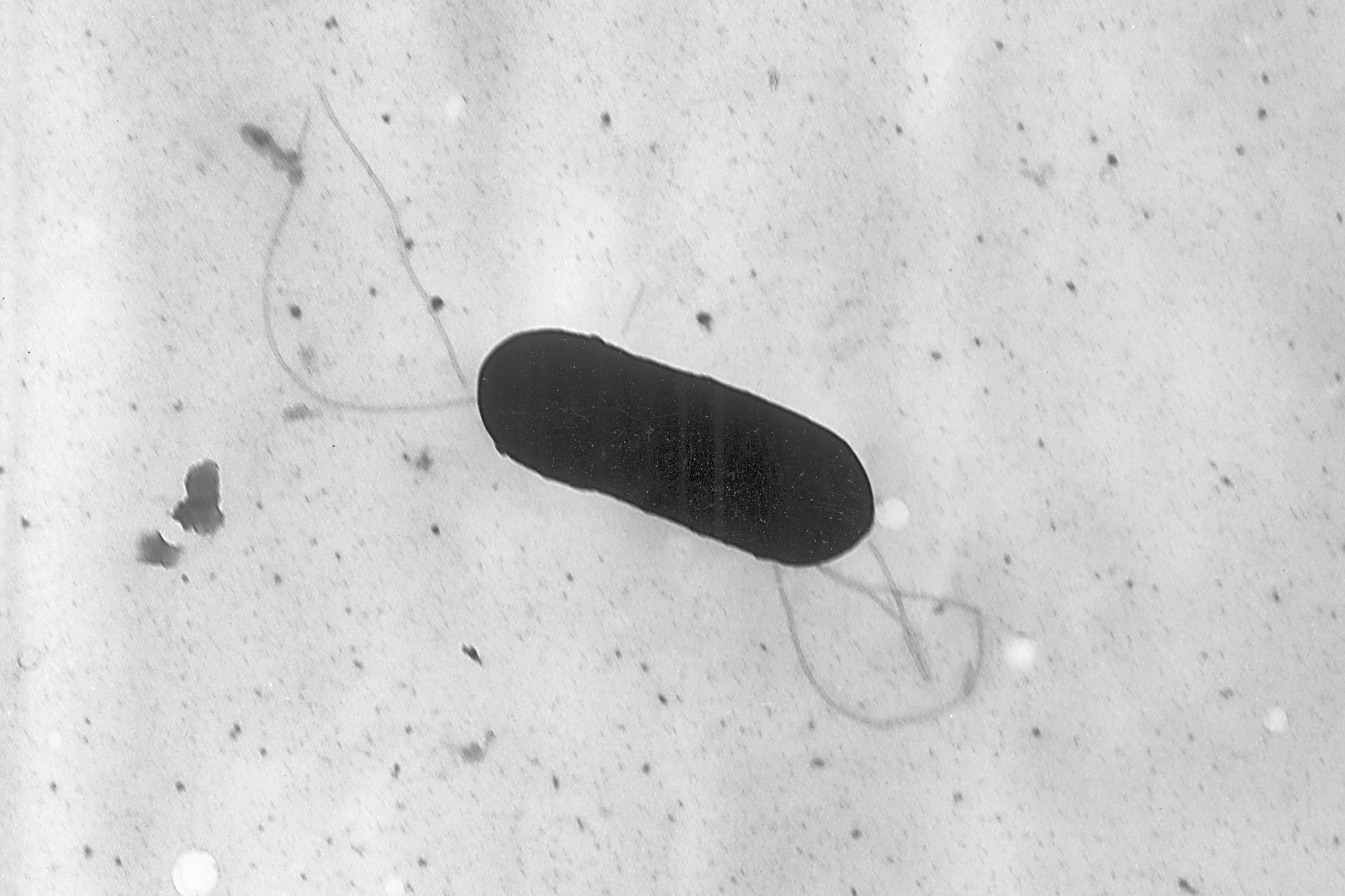 Esta imagen tomada con un microscopio electrónico y facilitada por los CDC muestra una bacteria Listeria monocytogenes que causa la listeriosis.