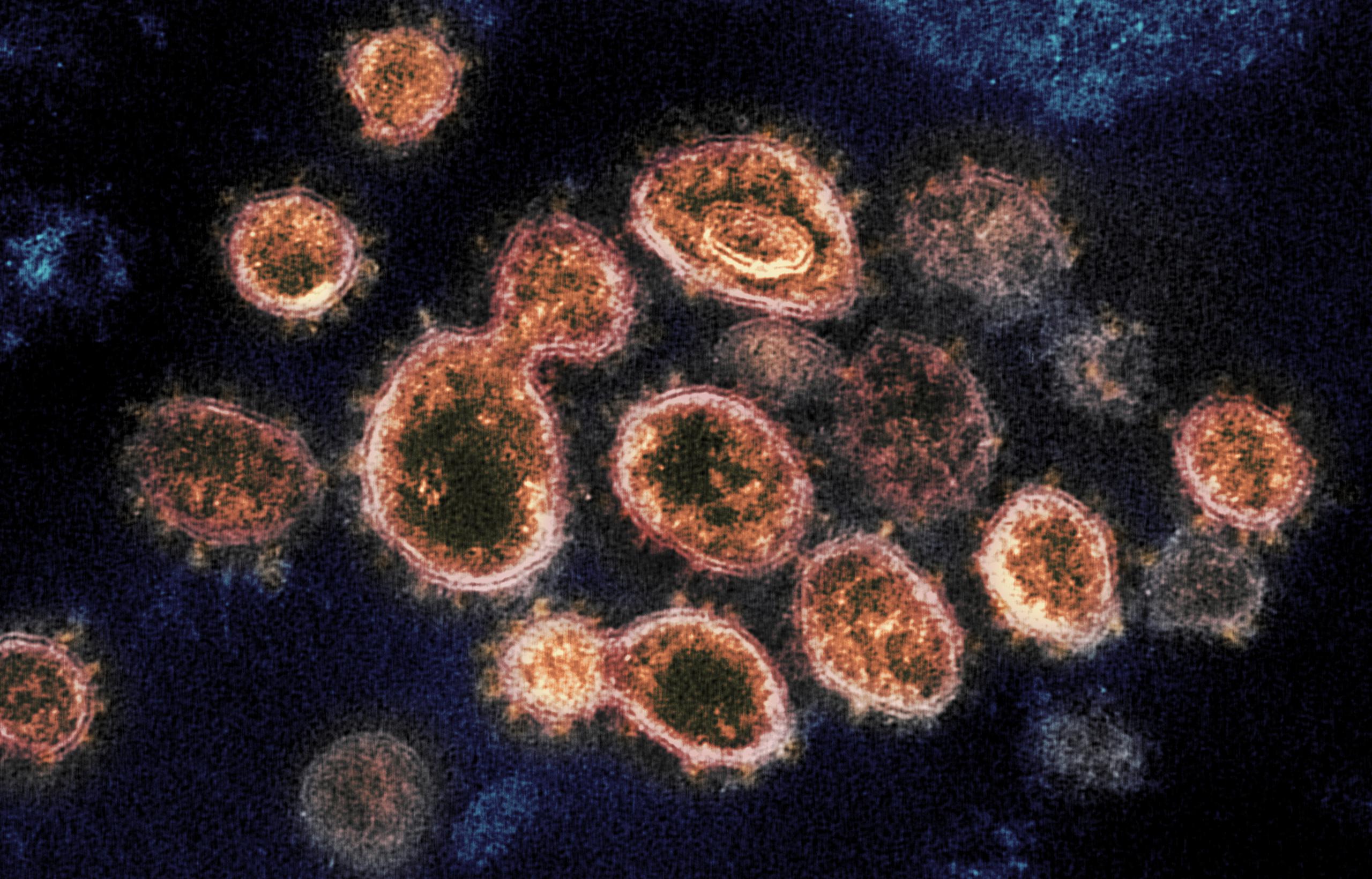 Aún no está claro si la exposición a otros coronavirus pudieran mostrar eficacia contra otros como el SARS o el MERS.