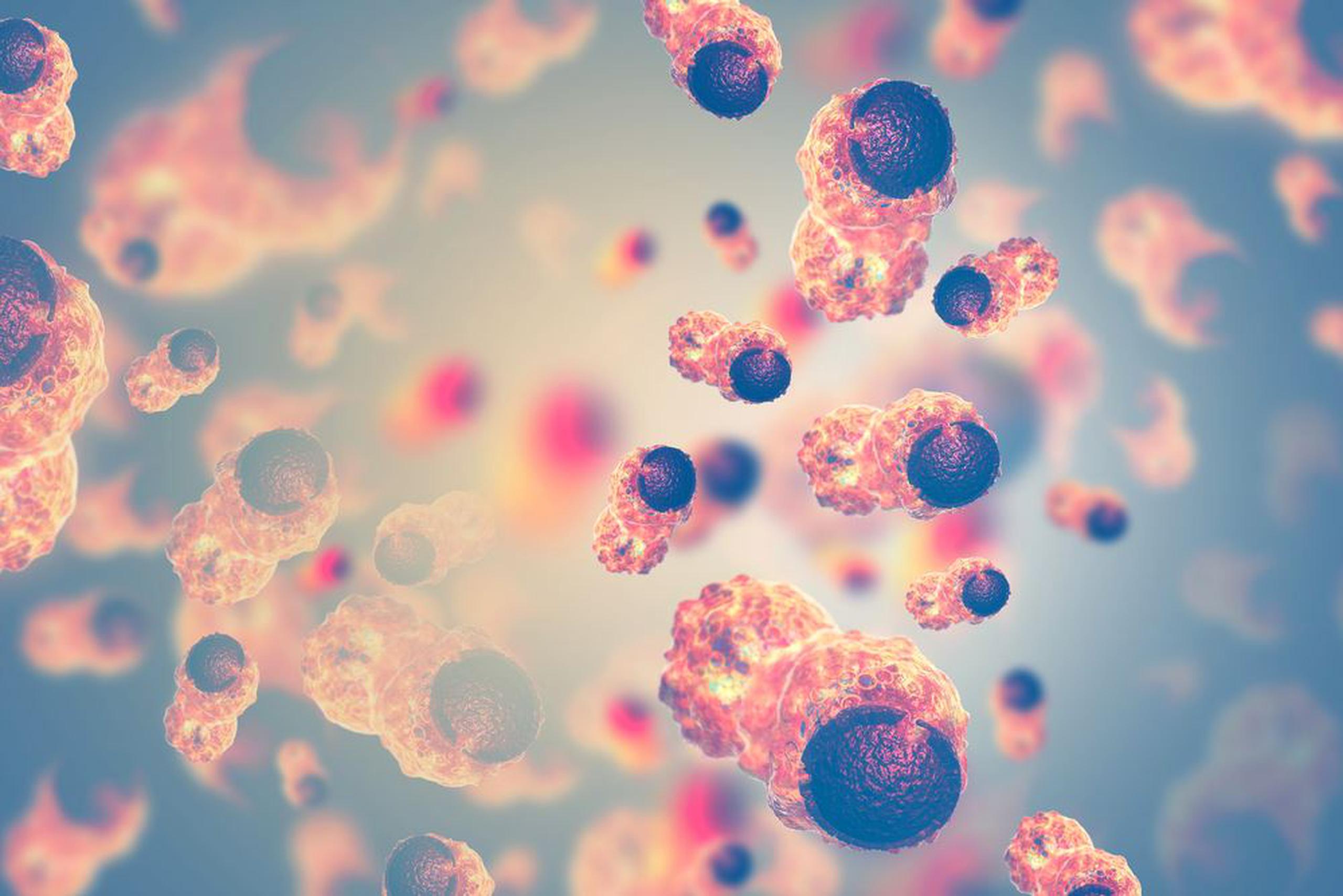 Imagen de células cancerosas. (Shutterstock)
