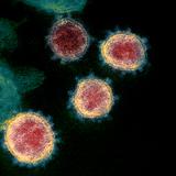 Biólogos señalan que el coronavirus tiene origen zoonótico