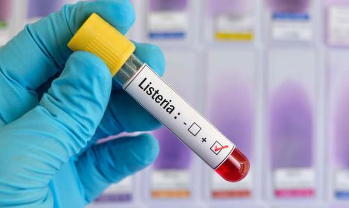 España emite alerta internacional por brote de listeriosis Primera Hora