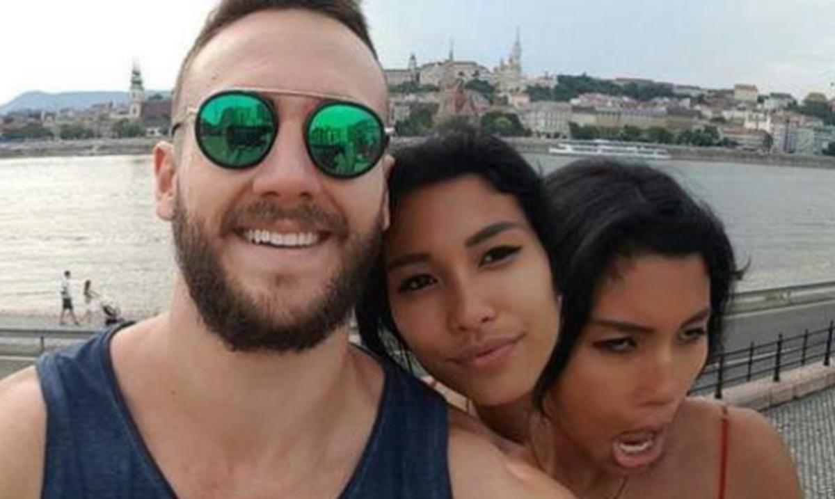 Imagen de joven con "dos cabezas" se vuelve viral Primera Hora