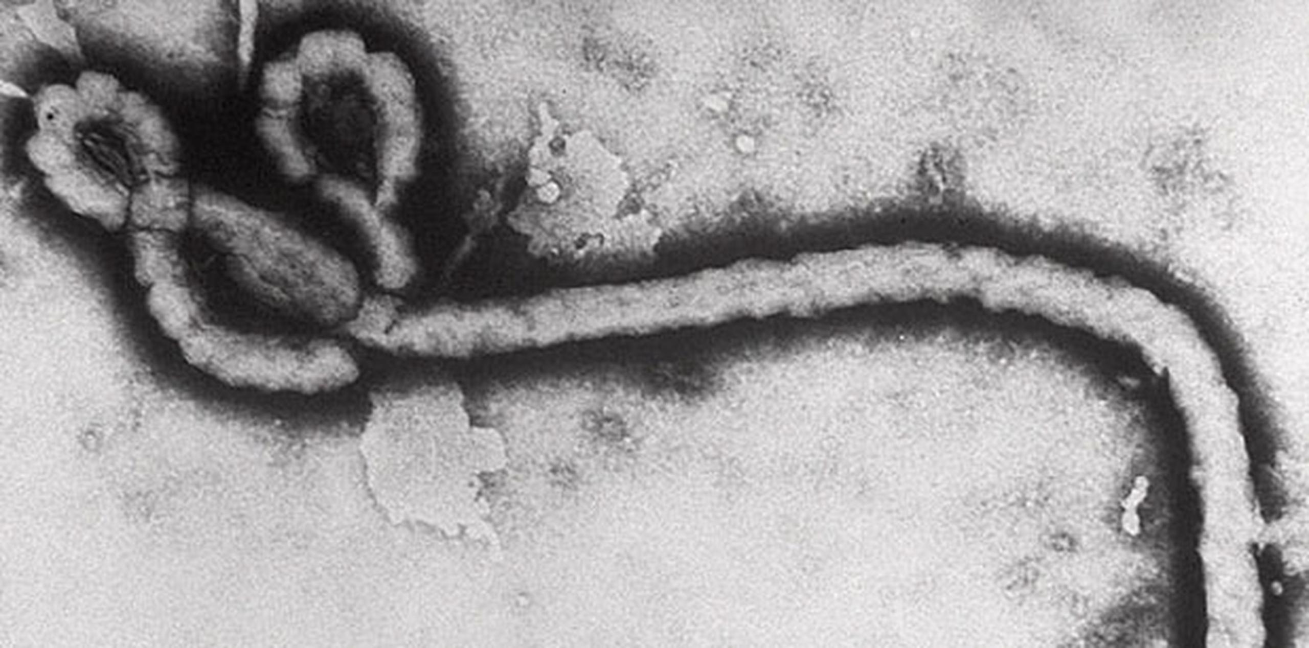Miles de equipos recorrerían el país, llamando a las puertas para recordar a la gente cómo se extiende el ébola y cómo prevenirlo. (Archivo)