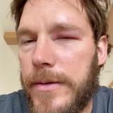 Chris Pratt sufre ataque de abejas tras intentar manejar una colmena