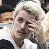 Justin Bieber revela que padece de síndrome que mantiene la mitad de su rostro paralizado