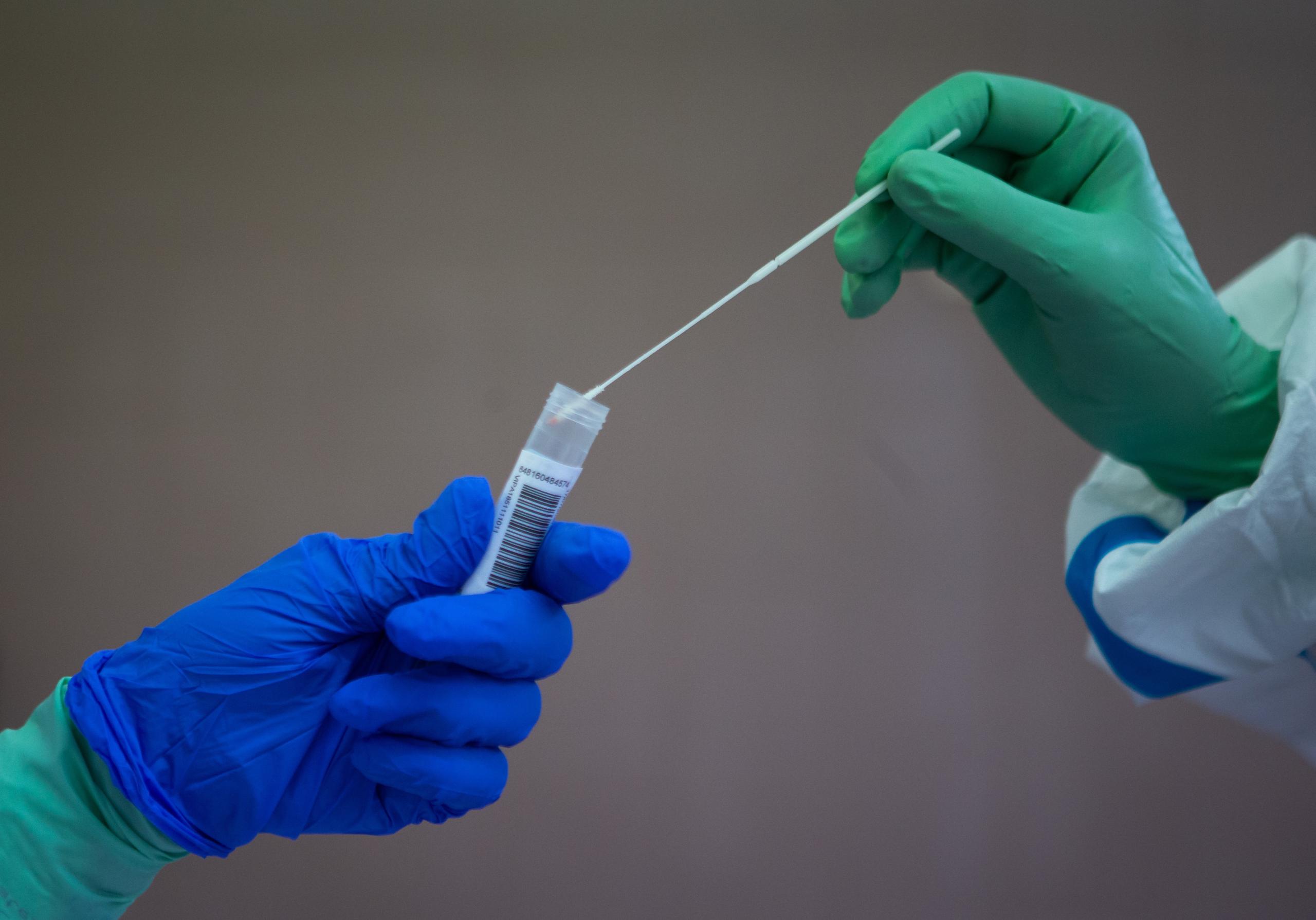 A los pacientes les realizaron pruebas moleculares para detectar el virus, se indicó.
