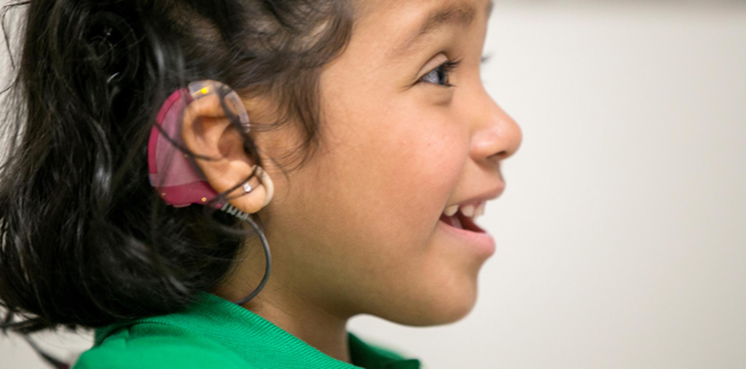 Los dispositivos implantados estimulan las células cerebrales a las que ordinariamente activarían los nervios auditivos. En la foto, Angélica López, niña de tres años que forma parte de los estudios. (AP)