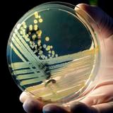 Nuevo avance contra las ‘superbacterias’