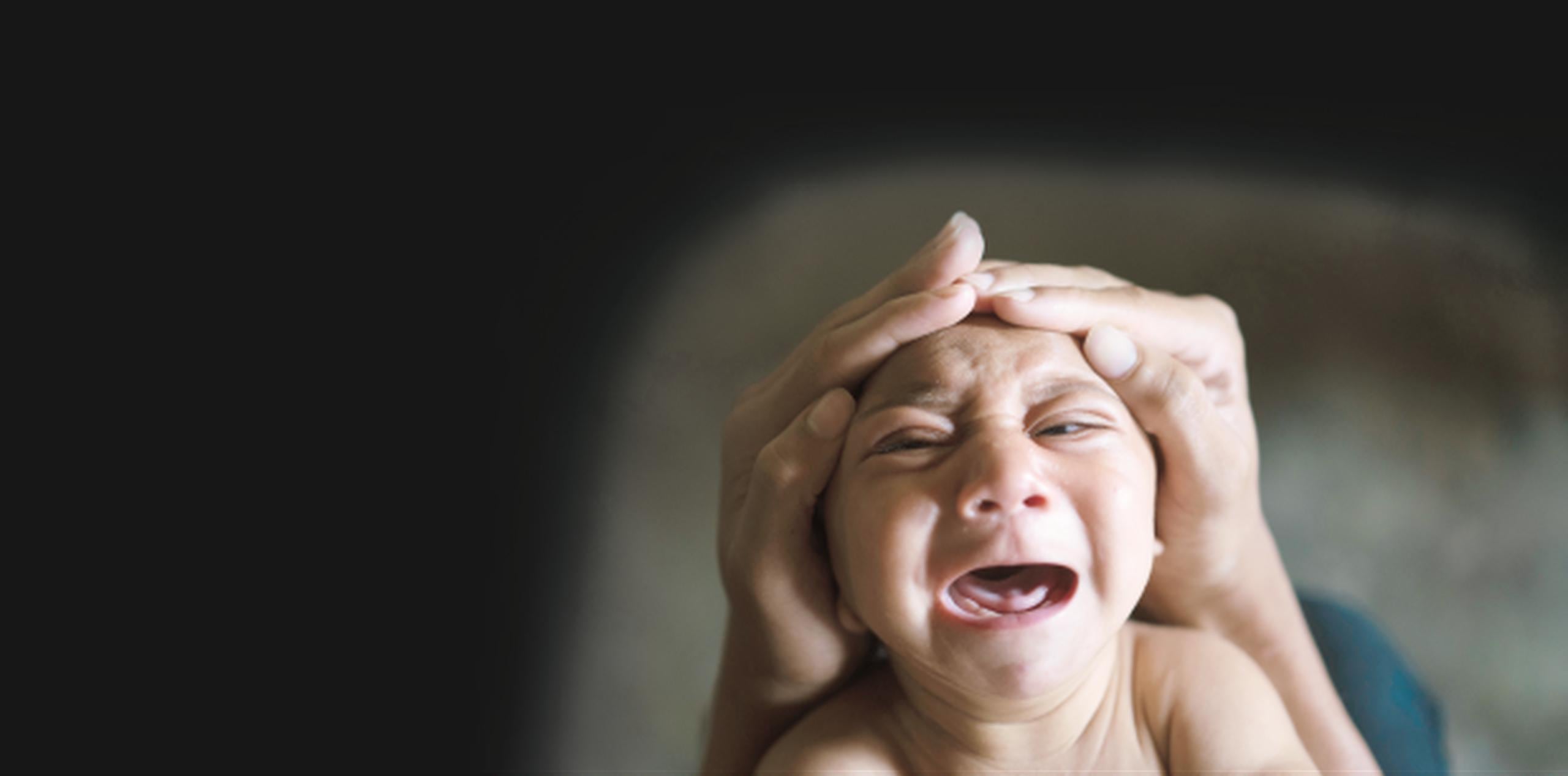 La microcefalia es una condición congénita que provoca que el cerebro no se desarrolle completamente y los bebés tengan una cabeza muy pequeña. (Archivo)
