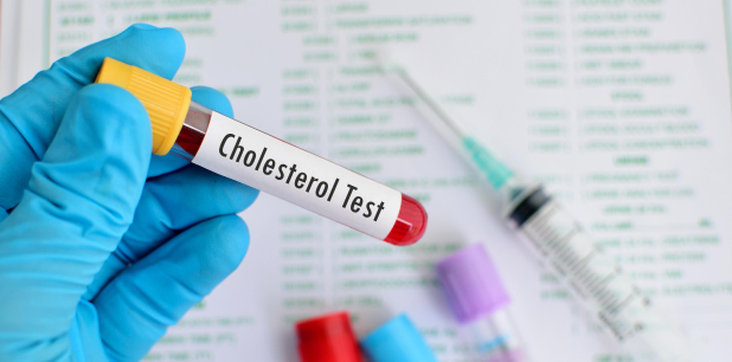 Unas 2.6 millones de personas mueren cada año por problemas derivados del colesterol, principalmente afecciones cardíacas. (Shutterstock)