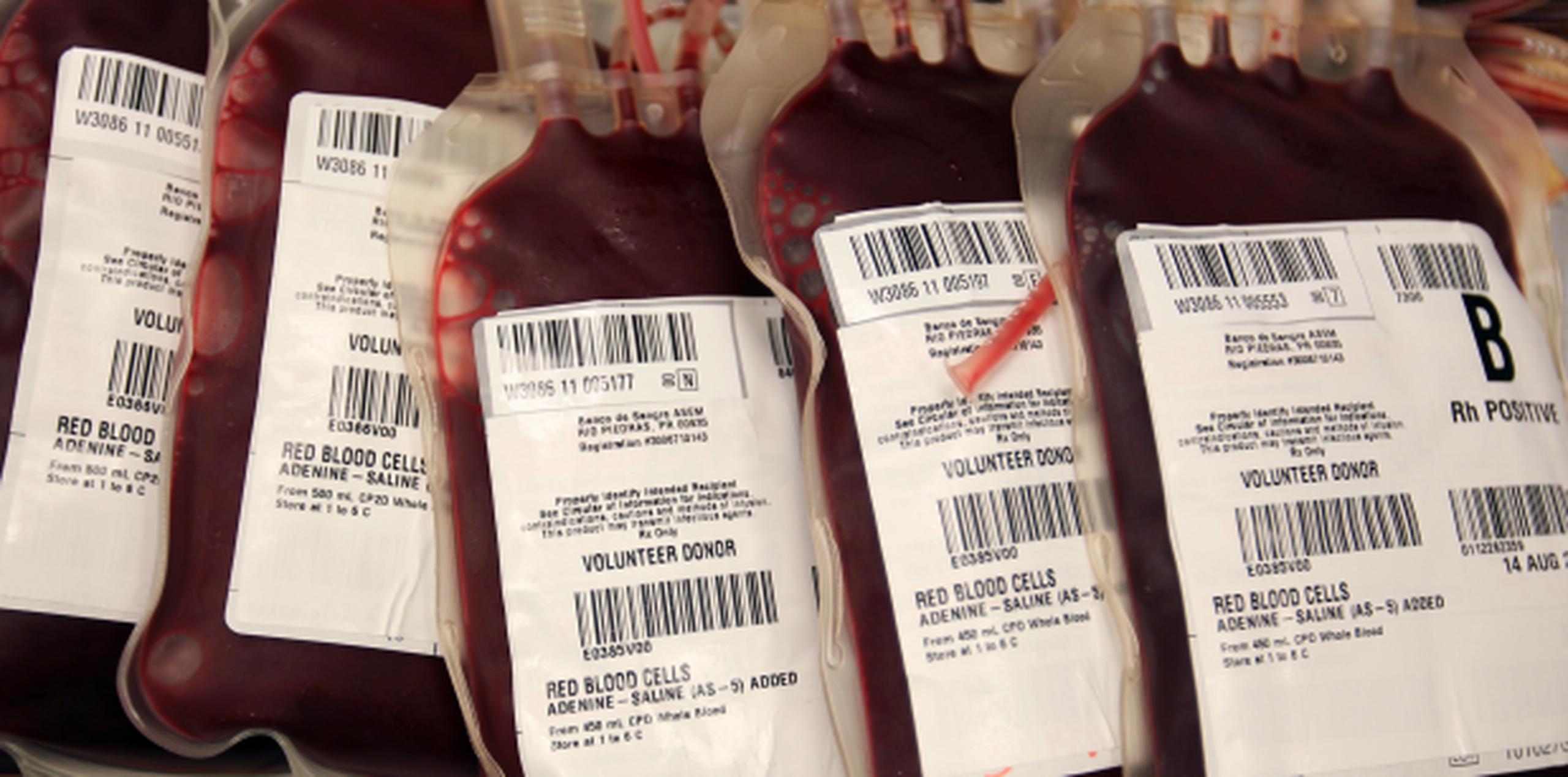 Las muestras que no se procesen en el tiempo requerido, conlleva que las unidades de sangre no se puedan utilizar y por ende, se tengan que descartar. (Archivo)