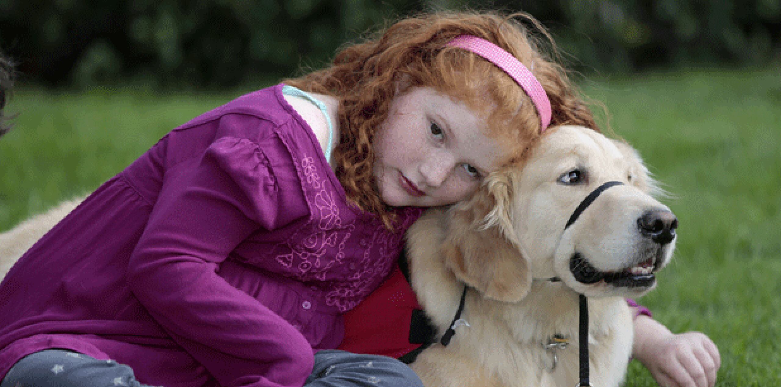Cuando Alyssa Howes tenía 4 años perdió la vista y empezó a tener ataques epilépticos, hasta veinte por día. (AP)