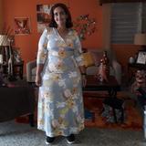 Beatriz Colón no está obesa: es lipedema y necesita de tu ayuda