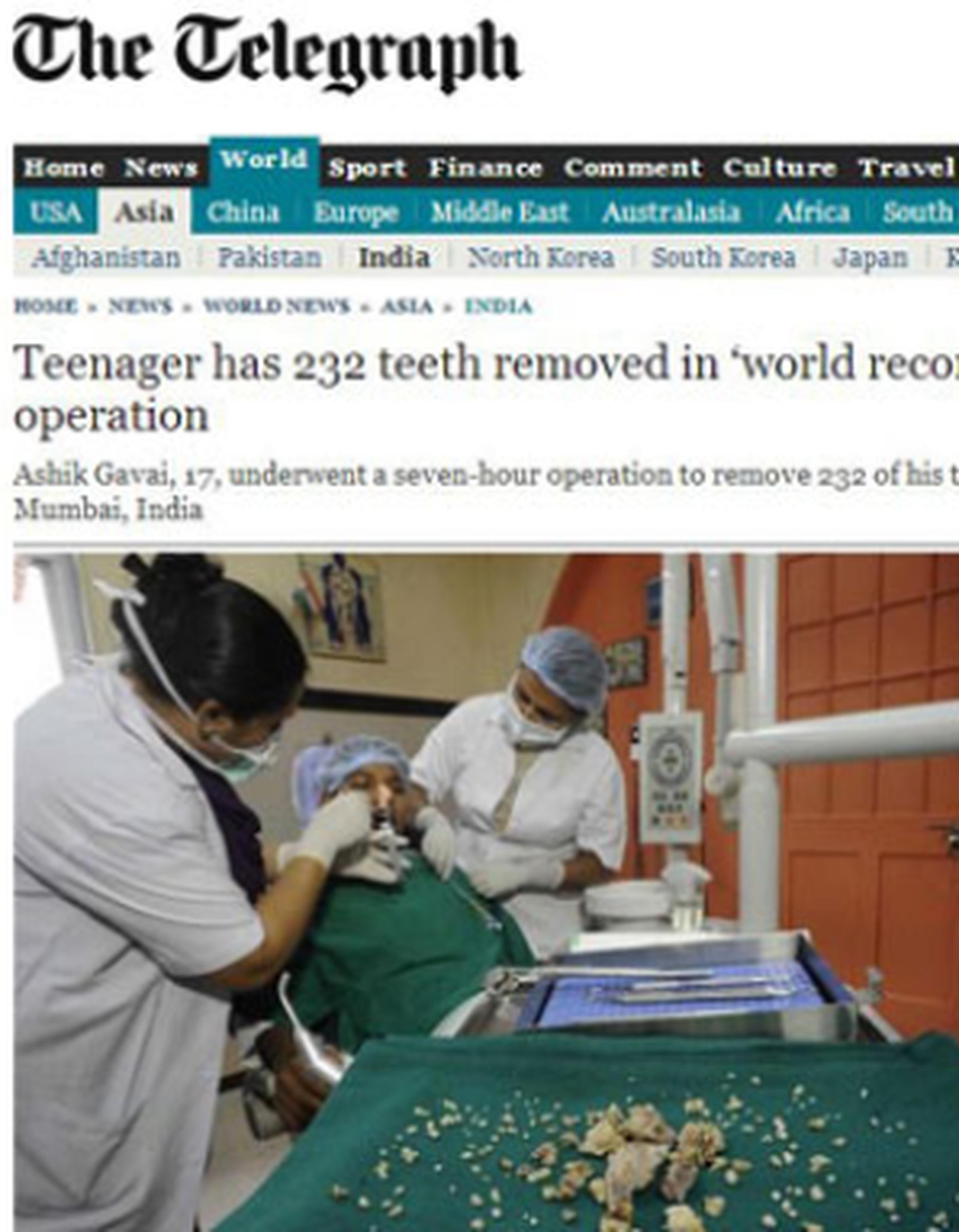 El paciente fue operado el pasado lunes por dentistas y otorrinolaringólogos. (www.telegraph.co.uk)