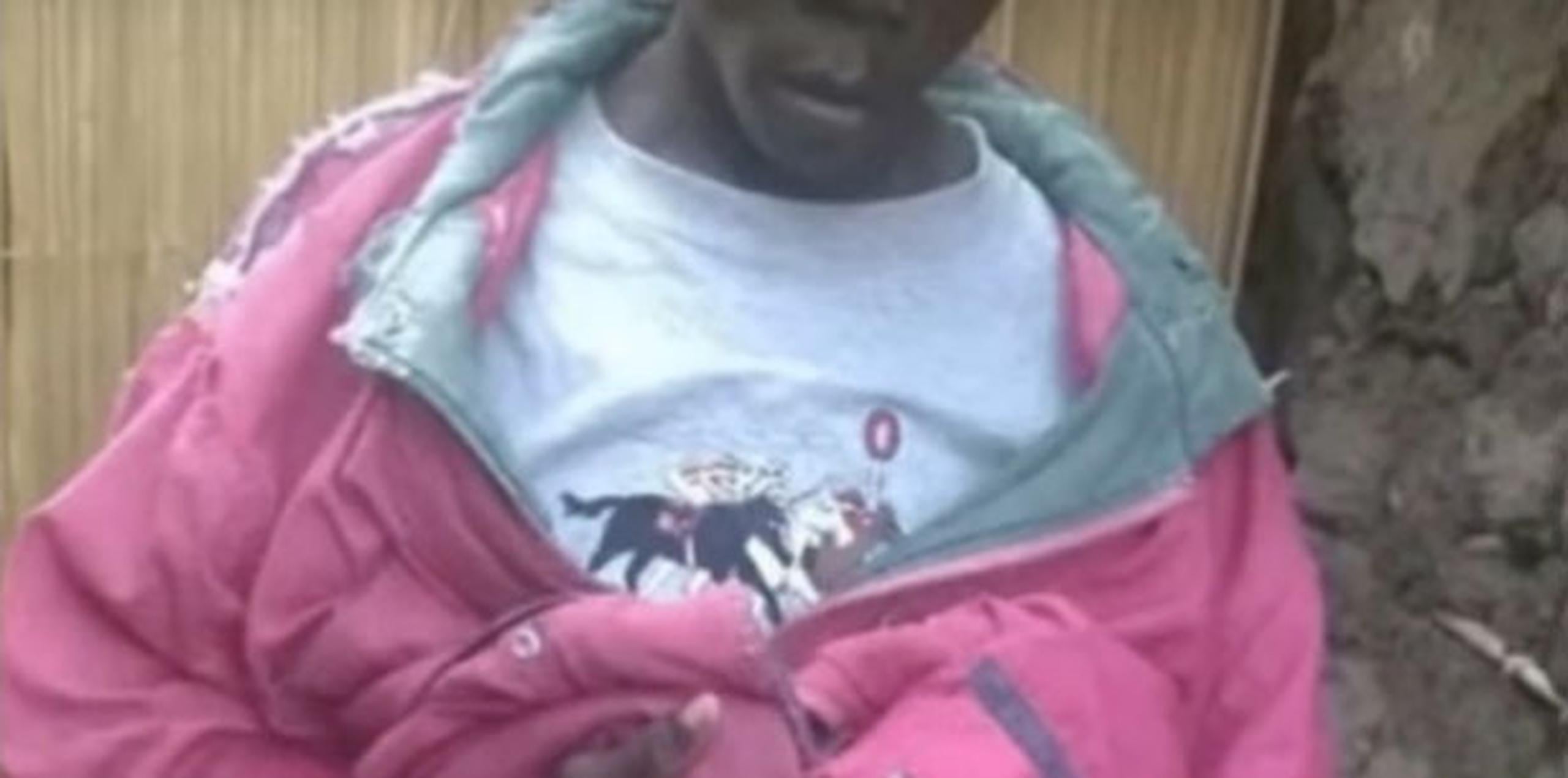 Su condición es la única en Kenya y posiblemente en África. (Youtube)