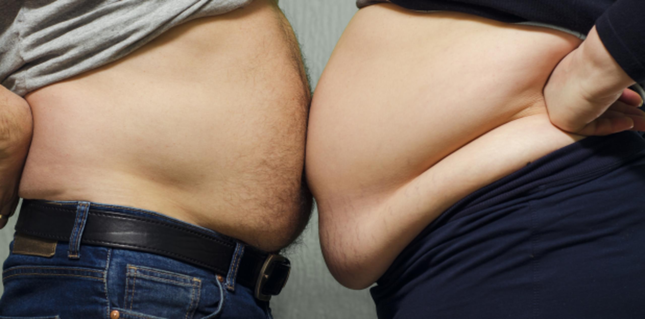 Al menos 2,000 millones de los 7,000 millones de habitantes del mundo tienen sobrepeso o son obesos. (Shutterstock)