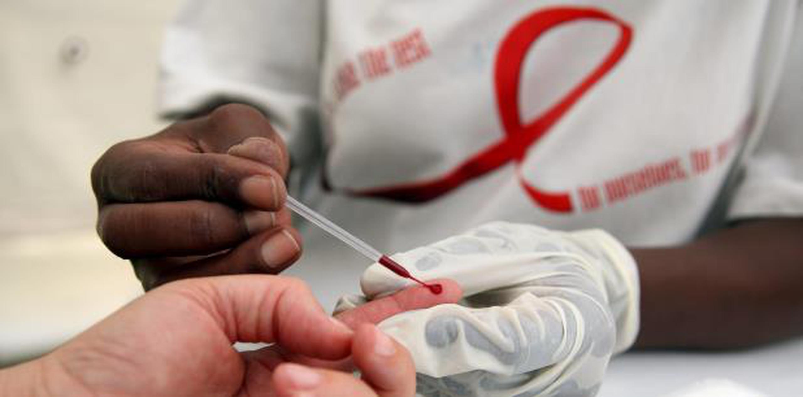 Apenas la mitad de los menores de 14 años con VIH está recibiendo tratamiento. (EFE)