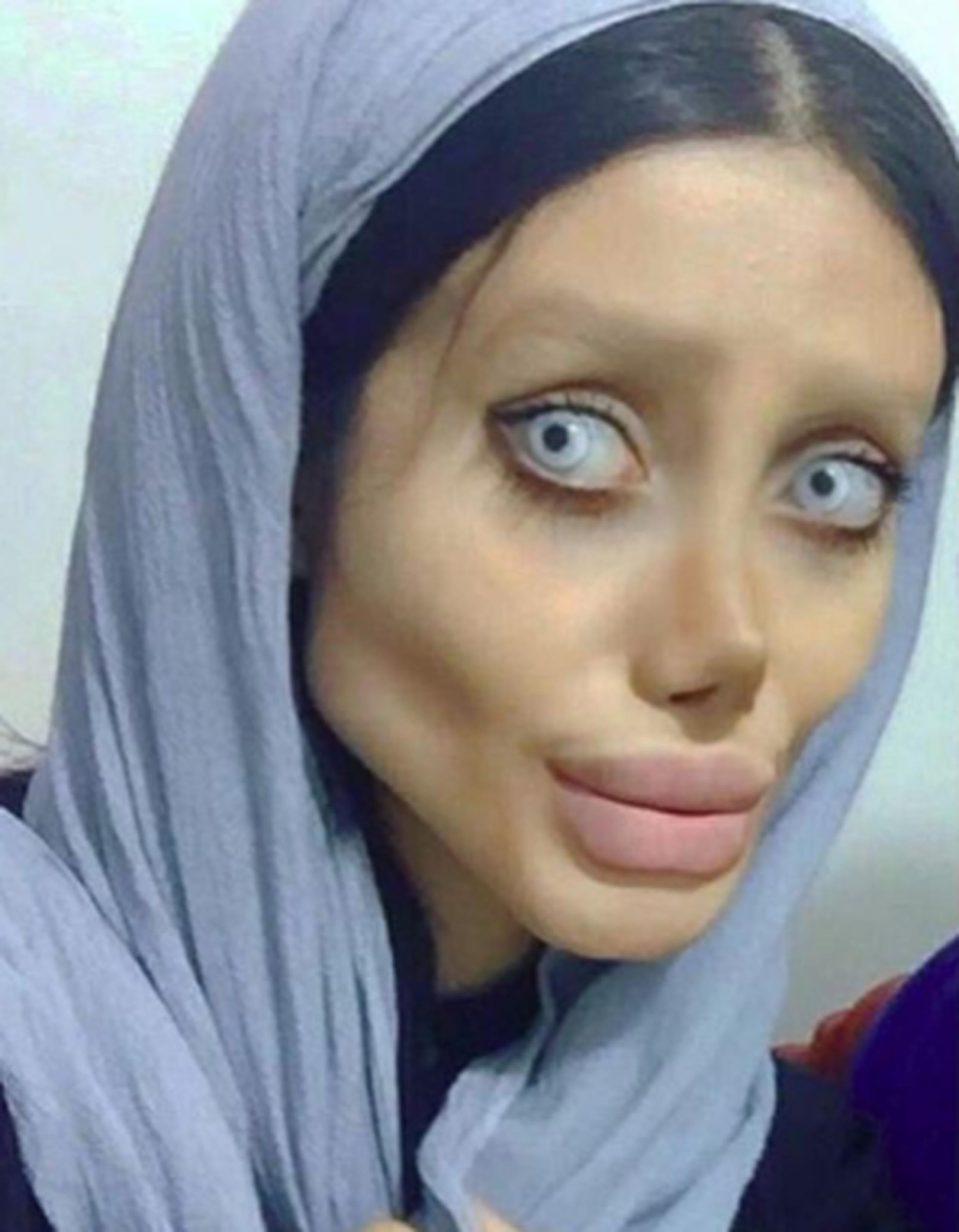 Las críticas y burlas hacia Tabar también inundaron las redes sociales, y hasta sus propios seguidores en Instagram afirmaban que más que parecerse a Jolie, se veía como un zombie. (Instagram)