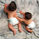 Mujer en Brasil dio a luz a gemelos de padres diferentes