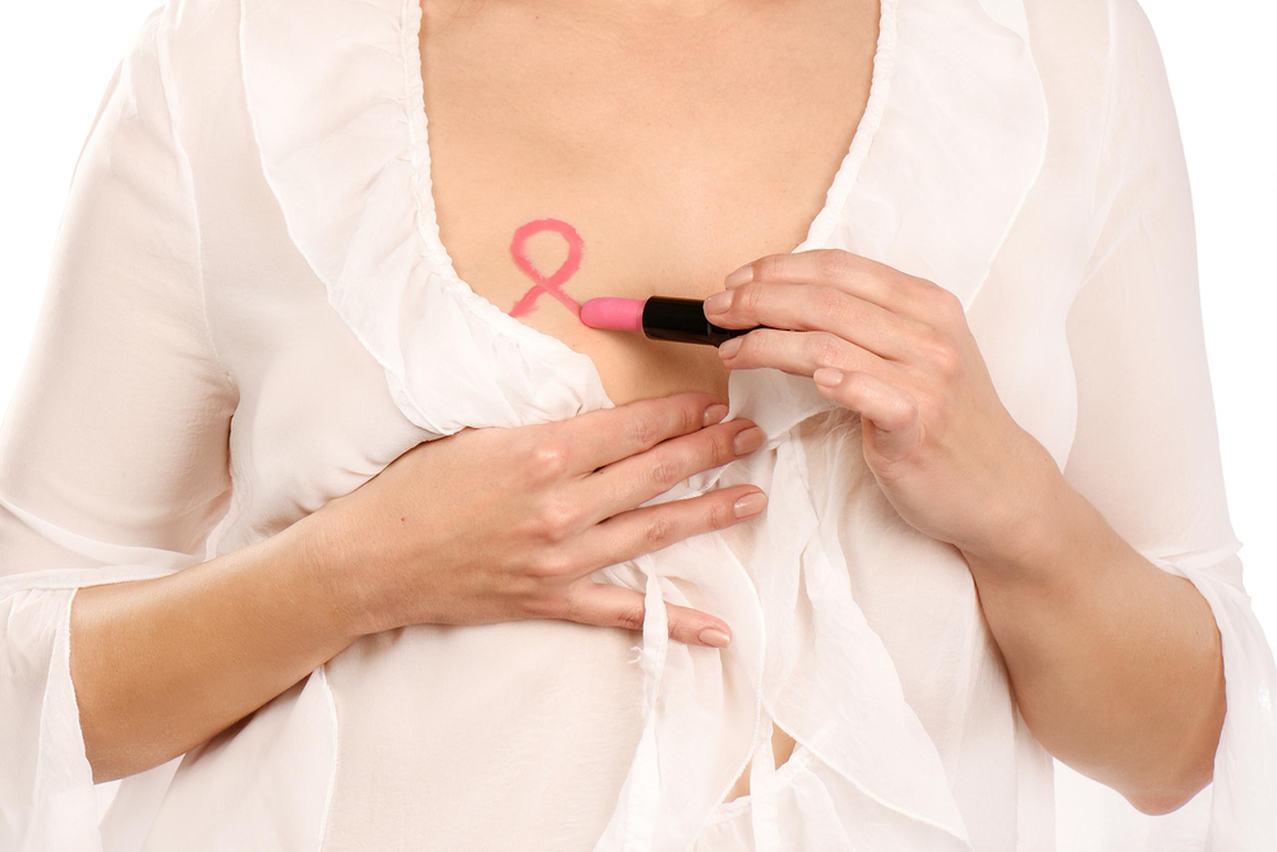 Más del 50 % de las pacientes a quienes se les recomienda una mastectomía desconocen sobre las opciones disponibles para reconstruir el seno.