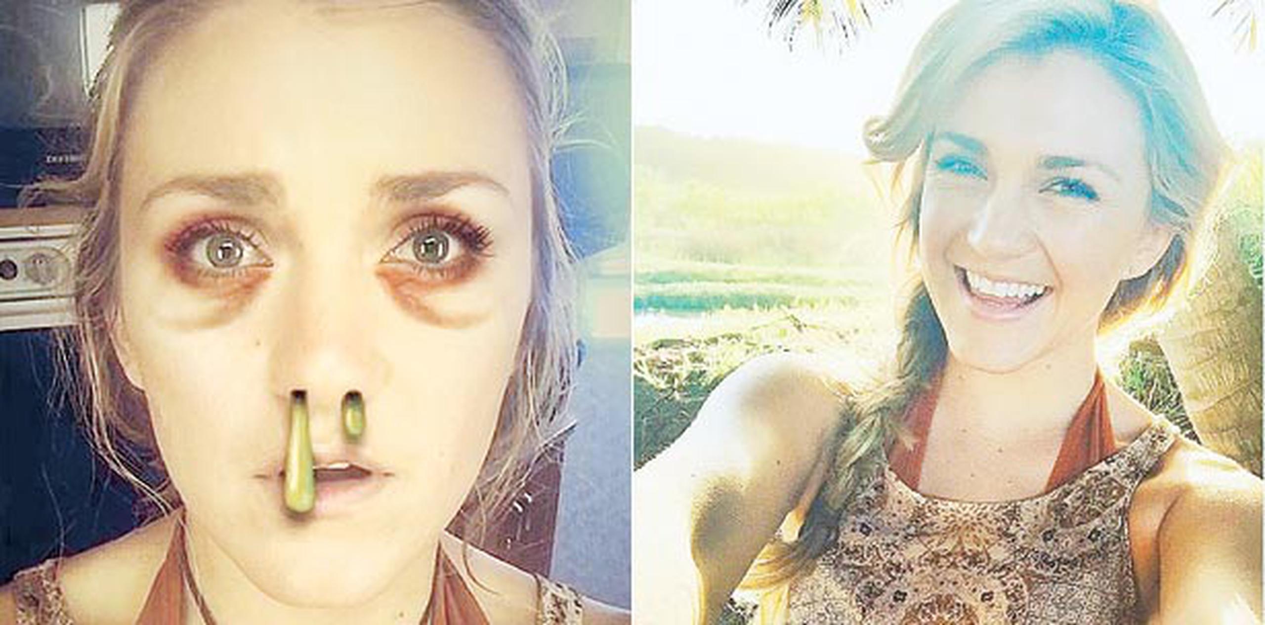 En el tiempo que la actriz Jessica Lowe estuvo en la Isla rodando Wrecked, fueron varias las veces que bromeó sobre el zika en sus cuentas de redes sociales. (Instagram/Jessica Lowe)