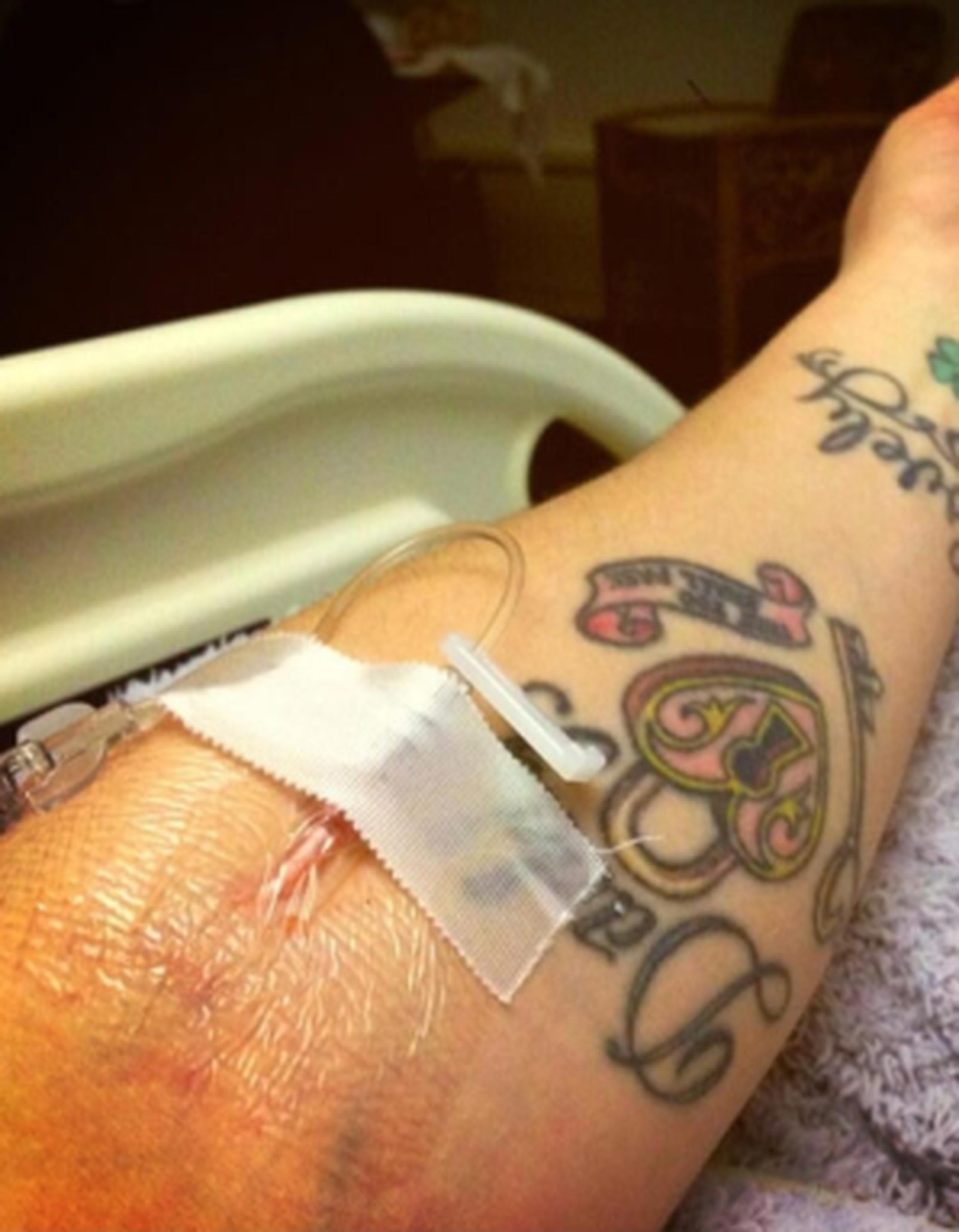 La presentadora de televisión de 28 años publicó una fotografía en Twitter la noche del jueves en la que se ve su brazo tatuado recibiendo una solución intravenosa en un hospital. (Twitter)