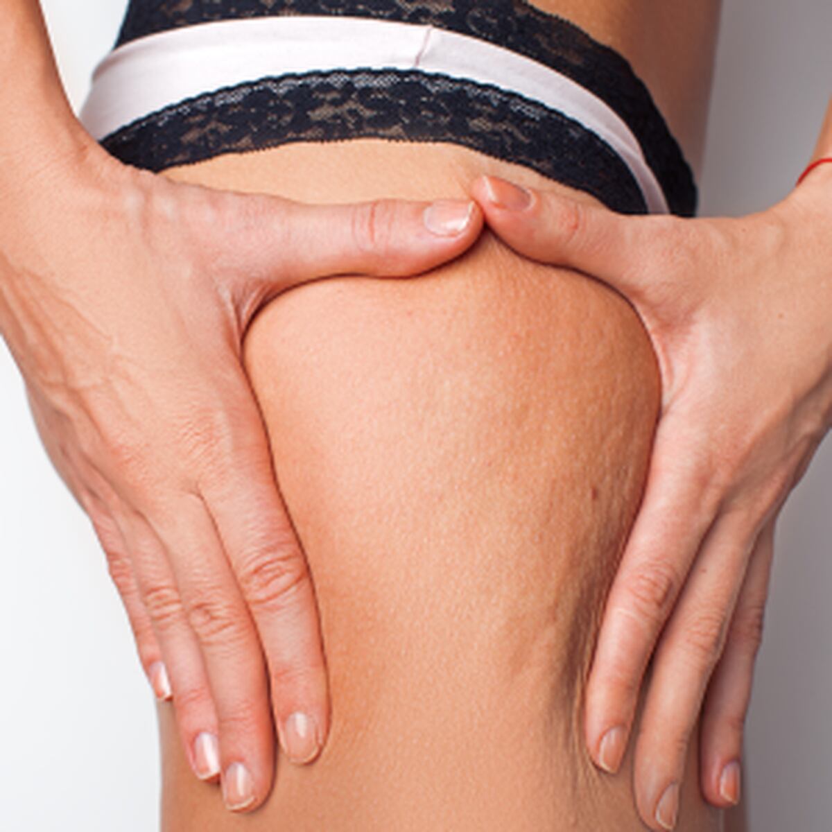 6 alimentos que producen mas celulitis