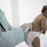 Mueren bebés con microcefalia ligada al zika en Panamá