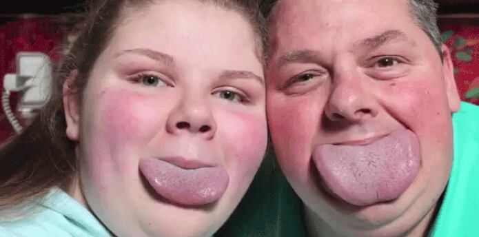 Byron Schlenker, de 47 años, y su hija Emily, de 14, fueron reconocidos por el Libro Guinness de los Records Mundiales por tener las lenguas más anchas del mundo. (YouTube)
