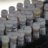 Eliminan de medida legislativa que farmacéuticos puedan interpretar pruebas de laboratorio