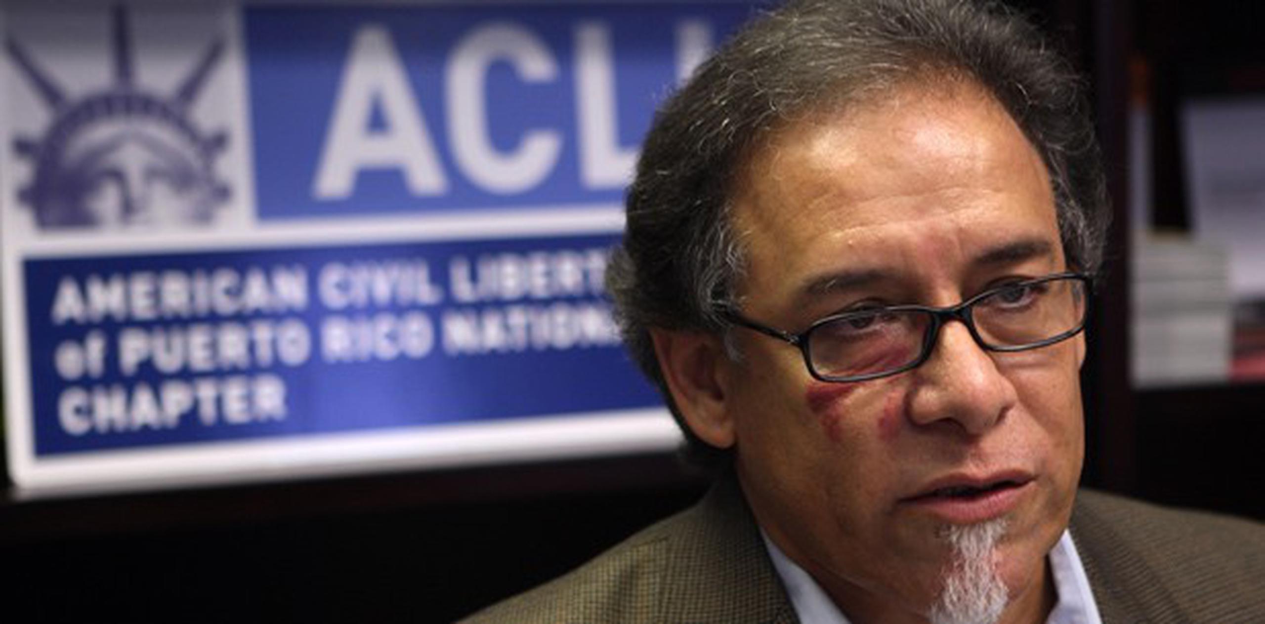 El director de ACLU, William Ramírez, indicó que la ACLU celebró una reunión de emergencia en la que se tomó la determinación. (Archivo)
