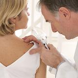 Inmunoterapia: avance contra el cáncer de piel