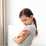 Cómo afecta la dermatitis atópica a los niños