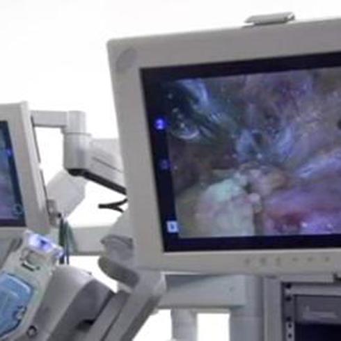 Exitosa primera cirugía robótica practicada a un niño en Colombia