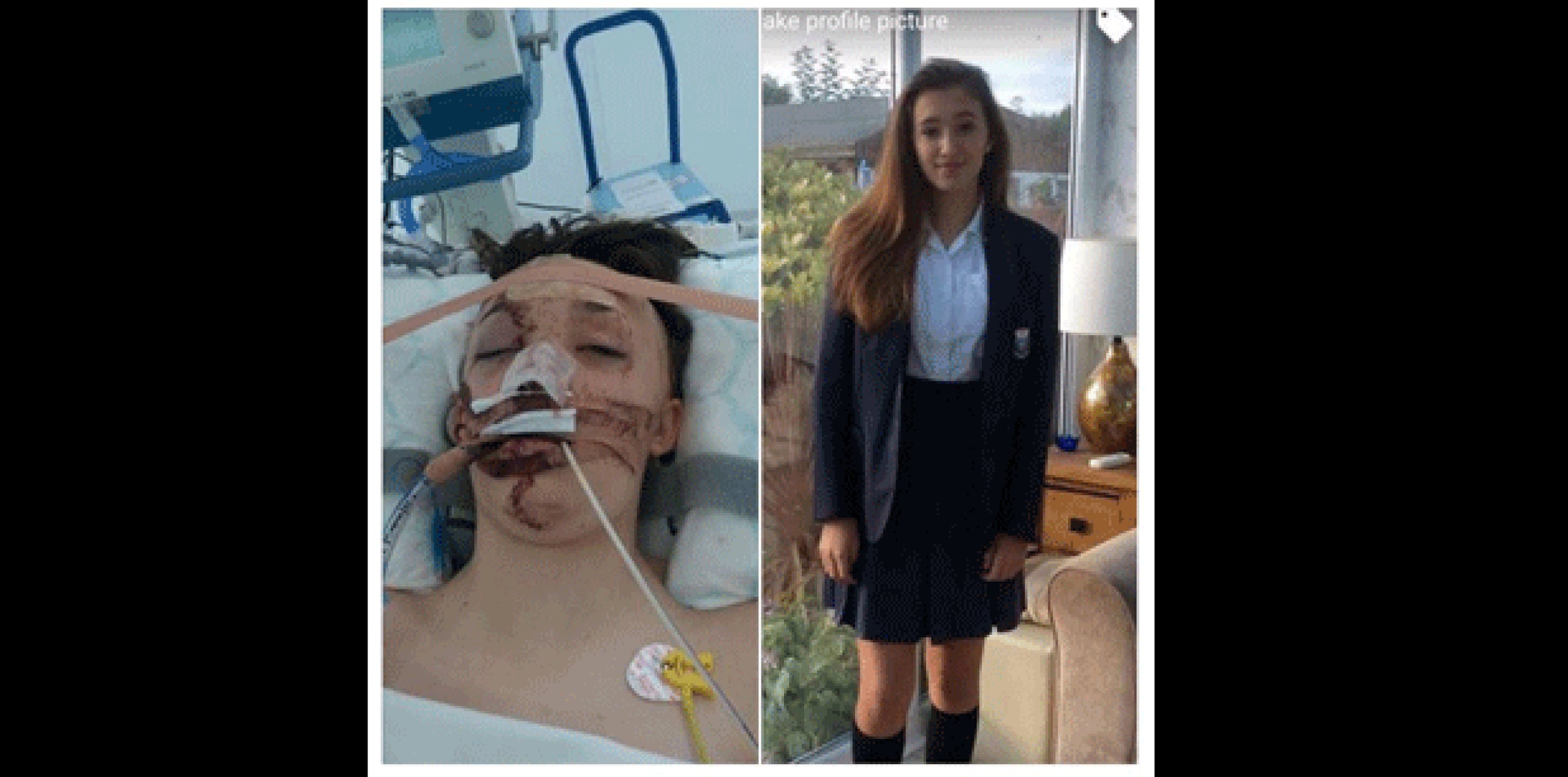 La joven fue trasladada en helicóptero al hospital Alder Hey de niños, en Liverpool, con lesiones en la cabeza y permanece en estado crítico, pero estable. (Facebook)