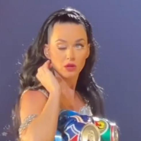 ¿Qué le pasó en el ojo a Katy Perry?