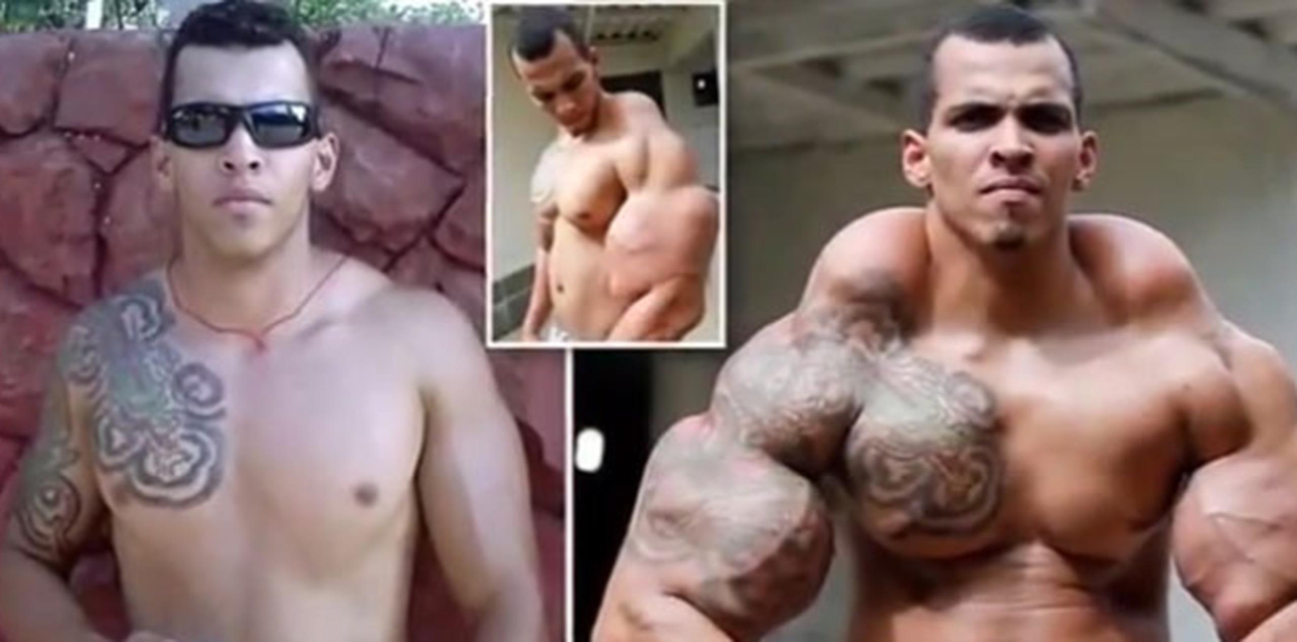 Romario Dos Santos Alves, en fotos antes y después del fármaco, exhortó a otros fisiculturistas a tener cuidado si usan alguna sustancia. (Youtube)