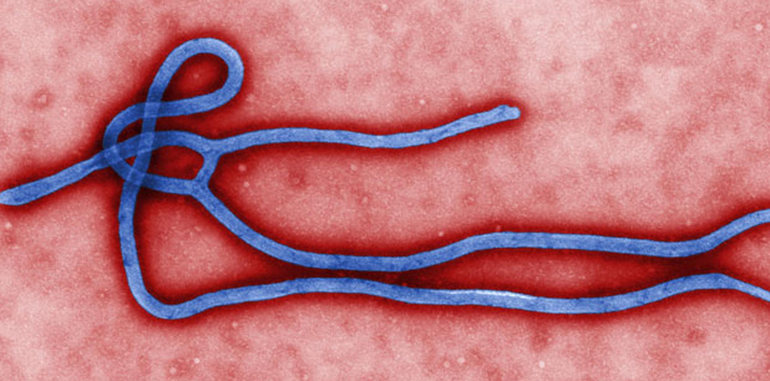 No se espera que el ébola juegue nunca en la misma liga que el sida en términos de contagios y muertes. (AP)