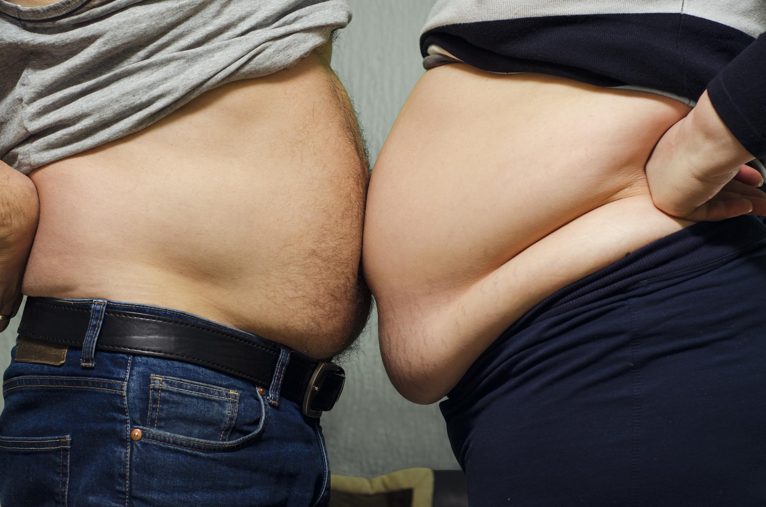 La obesidad se mide con el índice de masa corporal, con base en el peso y la altura de una persona.